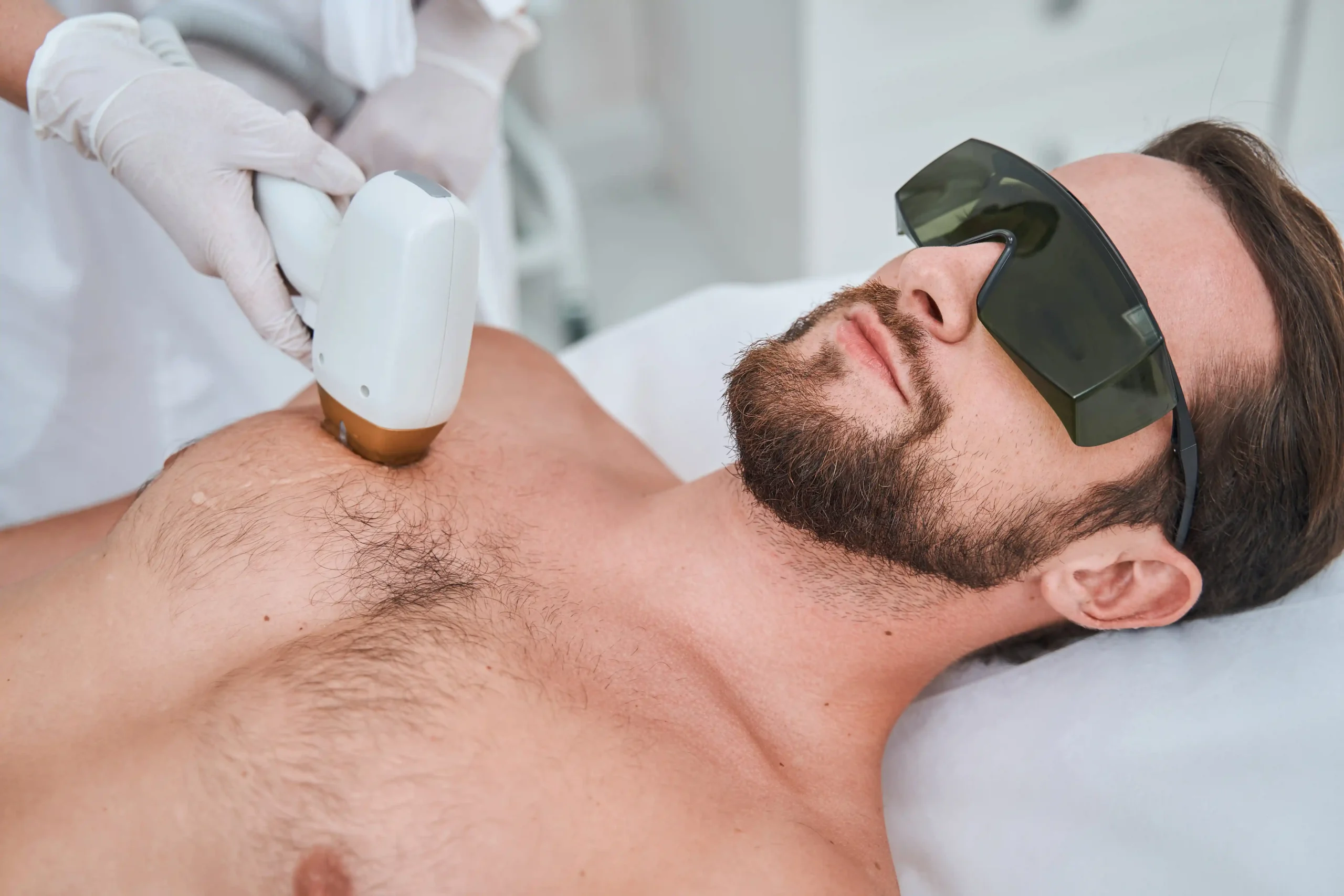 A bearded man wearing protective glasses lies on a treatment bed while a specialist performs laser hair removal for men on his chest using a handheld laser device.